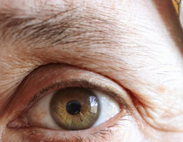 肌老化の8割は「光老化」