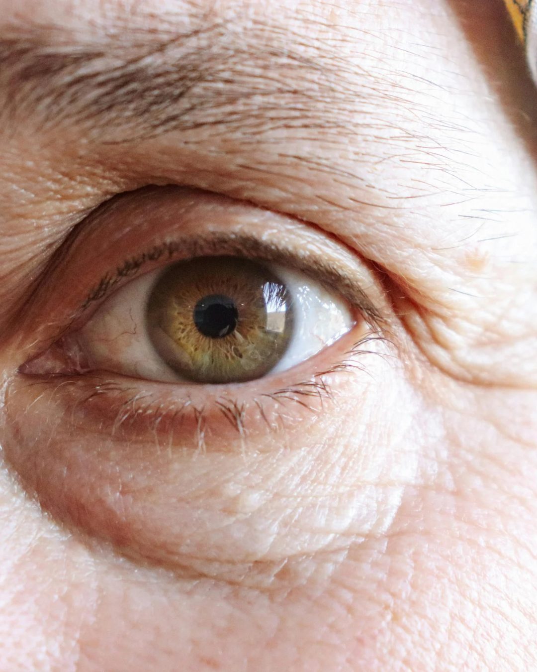 肌老化の8割は「光老化」